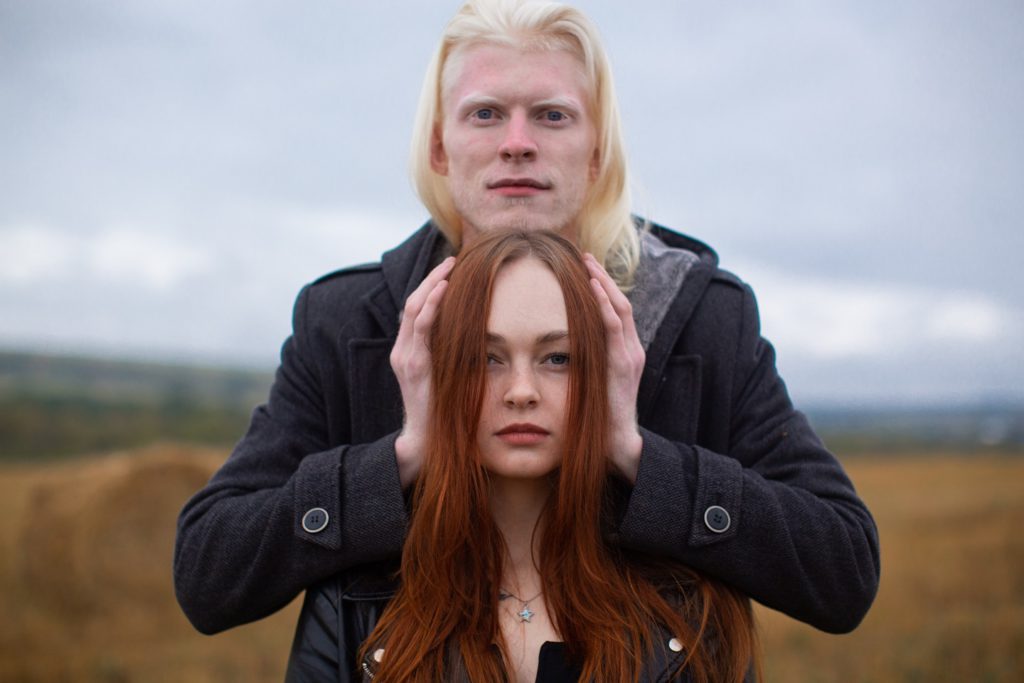 Albino man and redhead woman standing